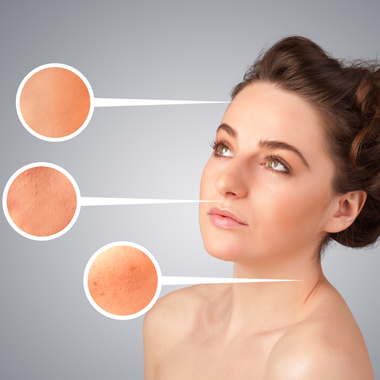 Tüntesd el a szemölcseidet végleg! 1-6 darab szemölcs végleges eltávolítása