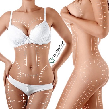 20% KEDVEZMÉNYRE jogosító bón PLASZTIKAI MŰTÉT árából, plusz Plasztikai sebész főorvosi konzultáció