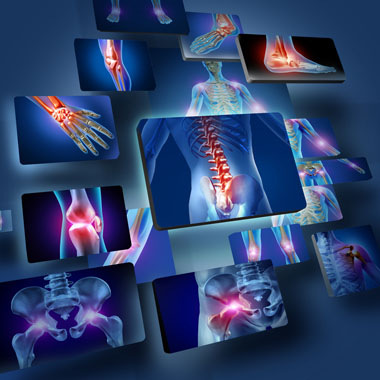 4 alkalmas egyedi terápiás gerinctorna