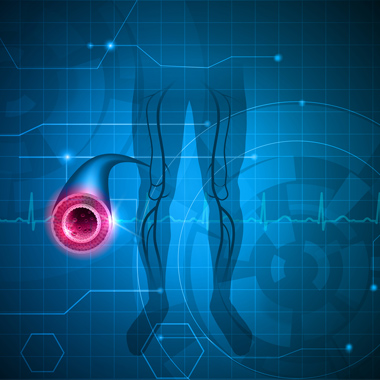 Agyvérzés, sztrók, hipertónia, trombózis… Előzd meg! Többkomponensű érvizsgálat csomag