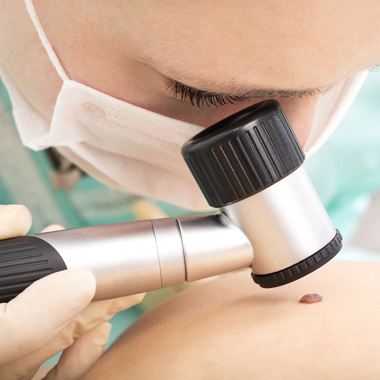 A maradandó következmények ellen: Anyajegy- és melanoma vagy egyéb bőrbetegségek szűrése