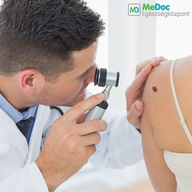 Bőrgyógyászati szakorvosi vizsgálat: szövettan + 1db anyajegy eltávolítása (kötözéssel, varratszedéssel)