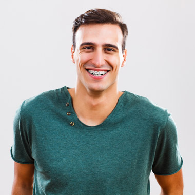 Legyen az idei mosolyod egészségesebb és szebb, mint a tavalyi: Fém fogszabályozó 1 fogívre fogkőleszedéssel