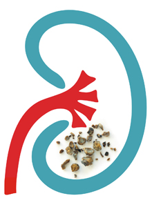 Kő kövön nem marad(hat)