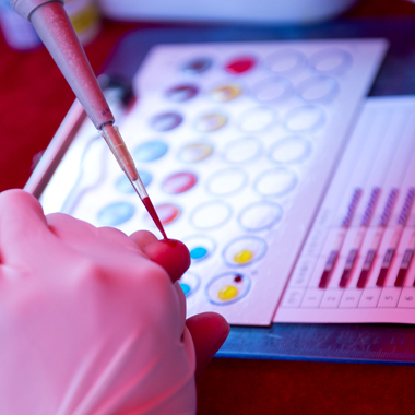 Biztos párosítás: Ételintolerancia teszt (20 féle ételre,összetevőre) és vércseppanalízis