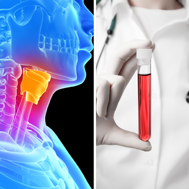 Labor útján történő alapos és körültekintő pajzsmirigy-szűrés + TSH hormon + Teljes vérkép + Akkreditált lelet + …