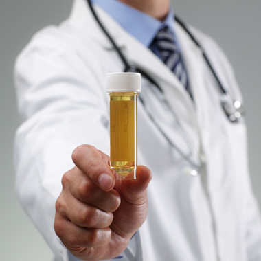 Jóslás helyett bizonyosság: Orvosi, kombinált vizeletteszt vitamin-, tápanyag-, ásványi anyag, mikroelem-hiány kimutatása.