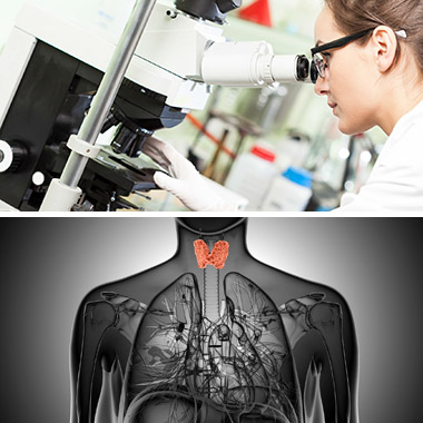 Hisztizel, hízol, hajat hullatsz? Speciális pajzsmirigy-szűrés, hormon, immunrendszer, tumor vizsgálat.