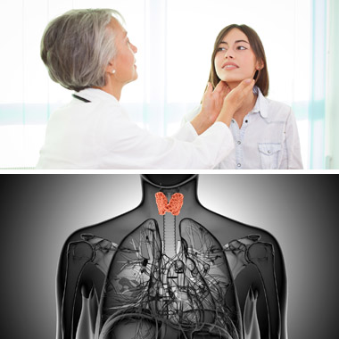 Hajhullás, hiszti, hízás? Valószínűleg a pajzsmirigyed a hibás: Speciális pajzsmirigy-szűrés tumorvizsgálattal