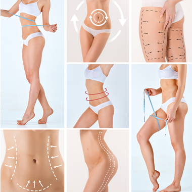 5 alkalom Thermolight lézeles zsírbontás, nyirokmasszázzsal