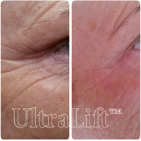 Kontúr Alakformáló Központ