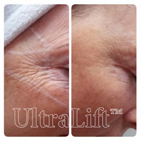 Kontúr Alakformáló Központ