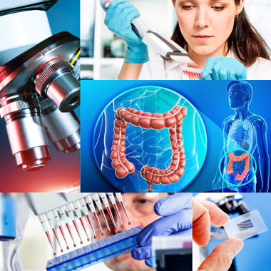 Mentsd meg tőle az életed, és a Szeretteidét is! Vastagbélrák kimutatására szolgáló vérvételi szűrőcsomag.