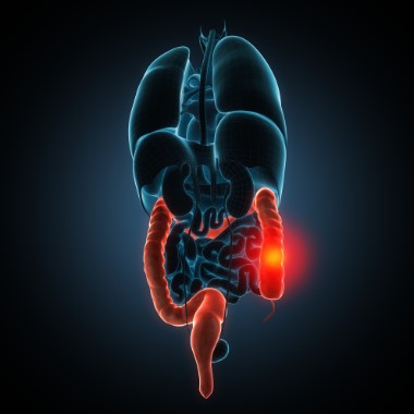 Vastagbélrák kimutatására szolgáló vérvételi szűrőcsomag, szakértői véleménnyel
