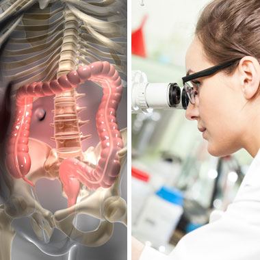 Vastagbélrák kimutatására szolgáló kétlépcsős szűrőcsomag 