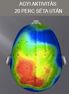 7 meghökkentő agykárosító szokás