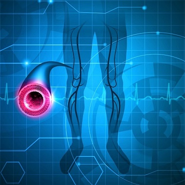 Végtagi ultrahangos doppler vizsgálat, választható 1 alsó vagy felső végtag, vagy 2 bónnal, 2 végtagra is elvégzik