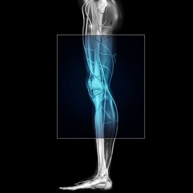 A figyelmedre ÉRdemes: angiológiai szakorvosi vizsgálat, alsó végtagi dopplerrel, érsebészeti konzultációval és scleroterápiáva