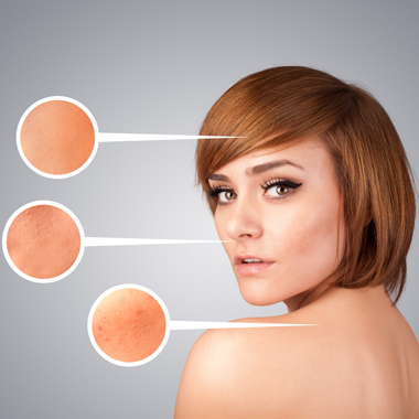 Távolíttasd el végleg bőrelcsúfító szemölcseidet bőrgyógyász-kozmetológus szakorvos által!