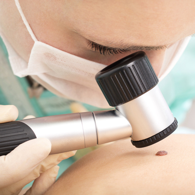 Megváltozott, viszket, újabbak jelentek meg a bőrödön? Szakorvosi ÉLETMENTŐ bőrvizsgálat, anyajegyszűrés.