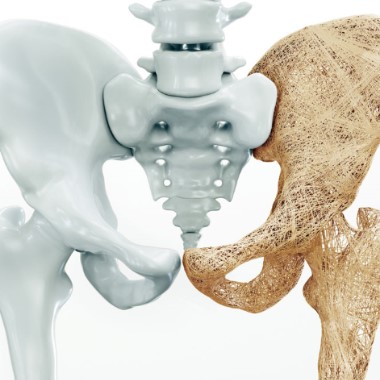 Csontritkulás laboratóriumi vizsgálatcsomag