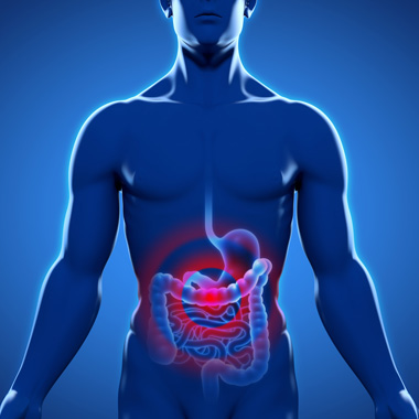 Részletekbe menő, fájdalommentes emésztőrendszeri felmérés (Helicobacter, laktóz, glutén, bélrendszer, candida…) 