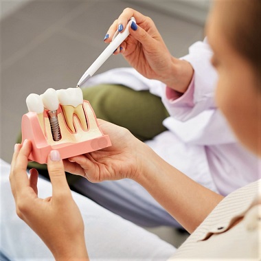 Fogászati implantátum konzultáció panoráma röntgennel, kezelési tervvel a Fehérvári Dental-nál előleg