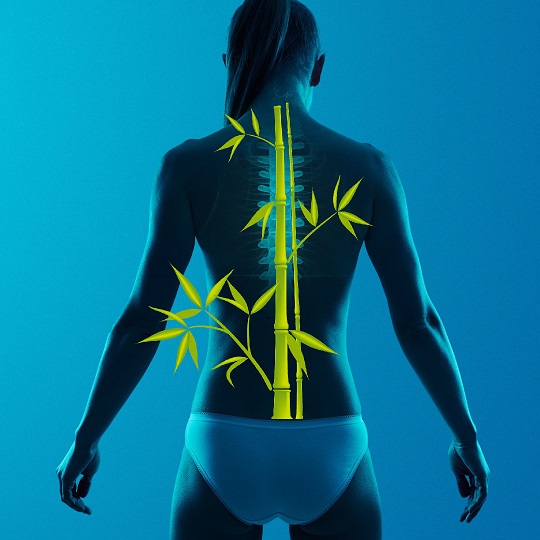 3 alkalmas Gerinc Selfness program, a hátpanaszok orvoslására