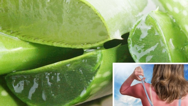 Gyógynövények a napégés gyógyítására