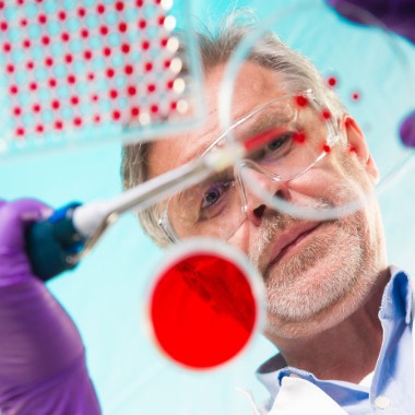 2 pontos inzulinrezisztencia laboratóriumi szűrés