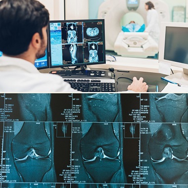 Ízületi natív MR vizsgálat, választható régióval, a RadiVert betegbarát klinikán!