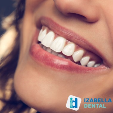 Fogzománcot épen tartó fogfehérítő kezelés, garantáltan magas minőségű fehérítő, zománckímélő anyaggal