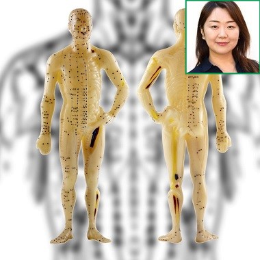 Kínai hagyományos orvoslás, akupunktúrás kezeléssel a Benyovszky Orvosi Központban