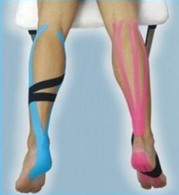 Gyors megoldás mozgásszervi fájdalmakra: Kineziológiai tapaszolás a Dr. Zhang Orvosi Rendelőben