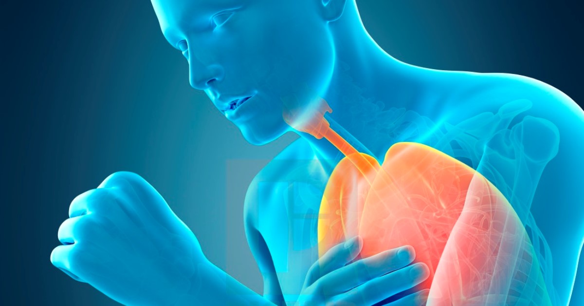 Mikor kell orvoshoz menni a köhögéssel?