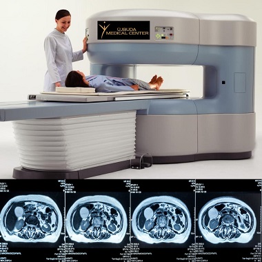 Natív MR vizsgálat 1 választható régióra, NYITOTT MR készülékkel az Újbuda Medical Centerben