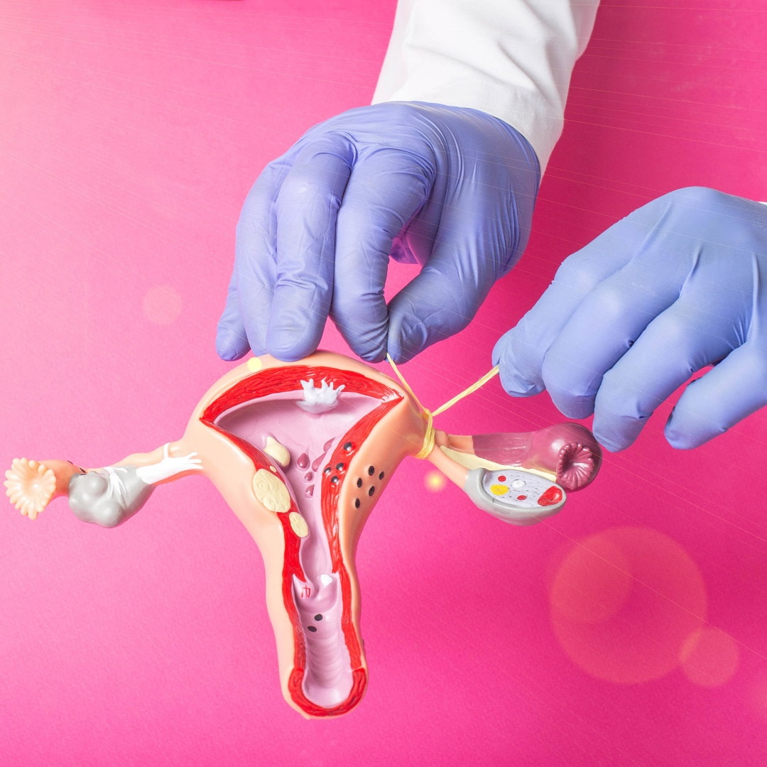 Nőgyógyászati kivizsgálás citológiával, Dr. Varsányi Antal nőgyógyász végzi