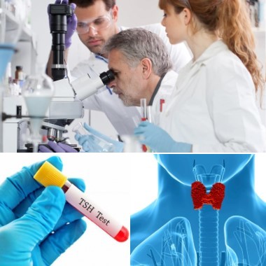 Laboratóriumi pajzsmirigy vizsgálat lelettel, írásos szakvéleménnyel