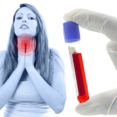 Ne legyél a hormonok marionettje! Labor útján történő alapos és körültekintő pajzsmirigy-szűrés 