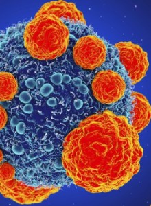 Új módszer a rák ellen.<br />
Mérföldkőhöz érkeztünk?