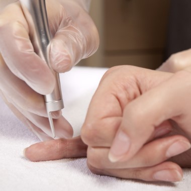 1-6 darab szemölcs eltávolítása bőrgyógyász-kozmetológus szakorvos által