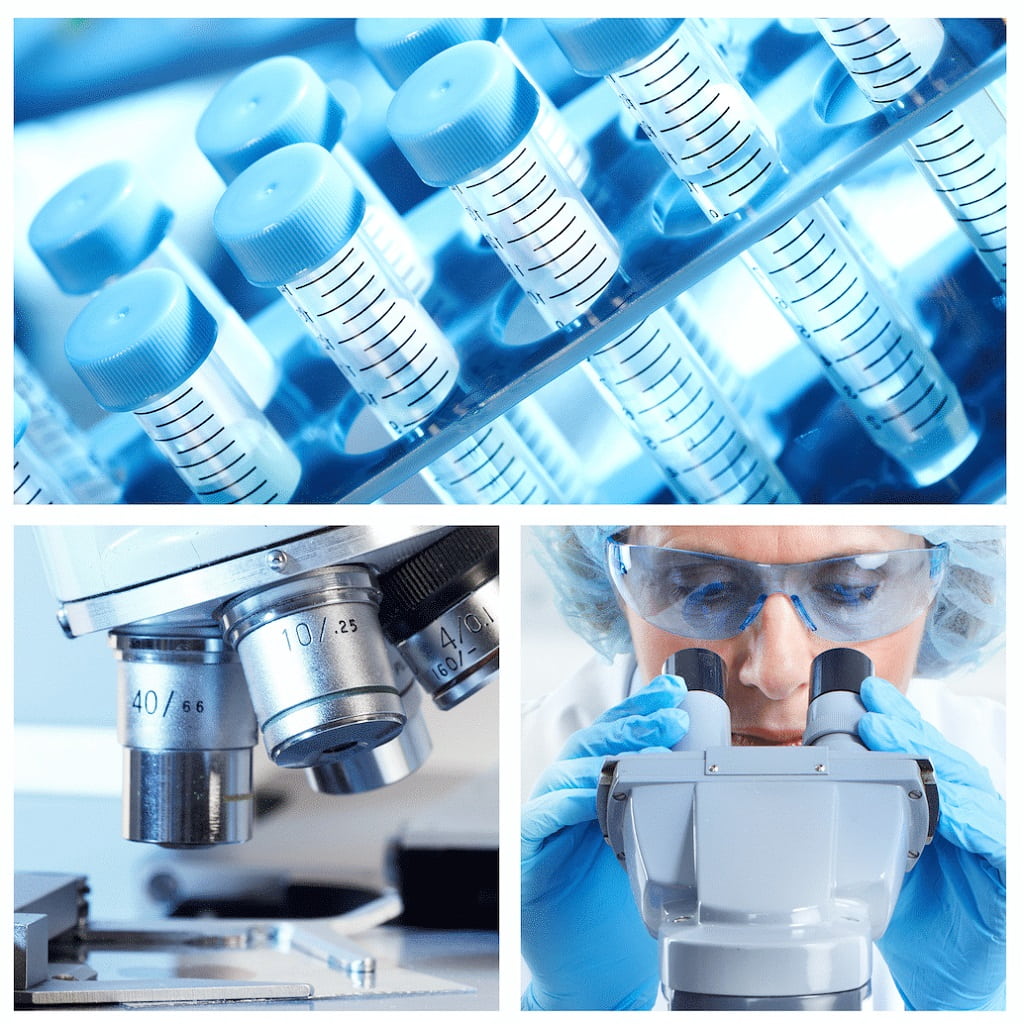 A leginkább elterjedt ráktípusok kiszűrésére: 5 tumormarkert tartalmazó szűrőcsomag Férfiaknak előleg