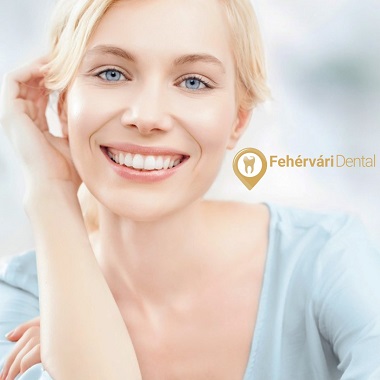 Ultrahangos fogkőeltávolítás állapotfelméréssel tanácsadással a Fehérvári Dentalnál , előleg