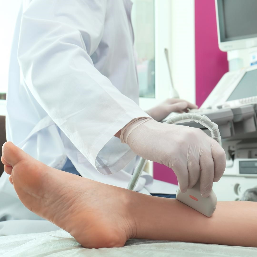 Végtagi ultrahangos vénás doppler vizsgálat, 1 választható végtagra