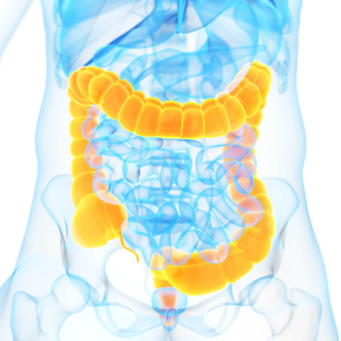 Kétlépcsős vastagbélrák kimutatására szolgáló vizsgálat szakértői véleménnyel
