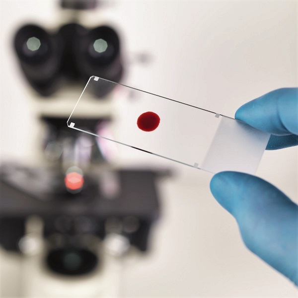 Vércseppanalízis 3 alkalom lézerterápiával