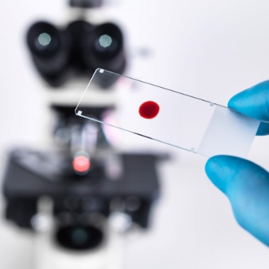 Vércseppanalízis ételintolerancia teszttel és candida-teszttel